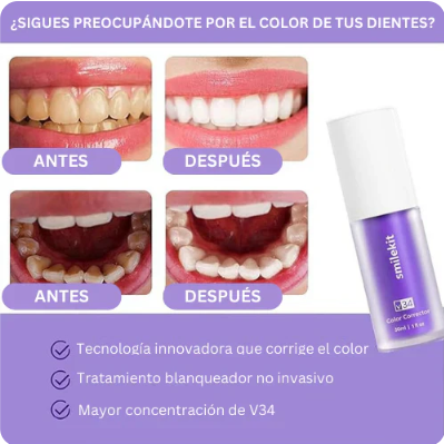 🤩SAFE SMILE✨🦷MEJORA TU HIGIENE BUCAL🦷✨